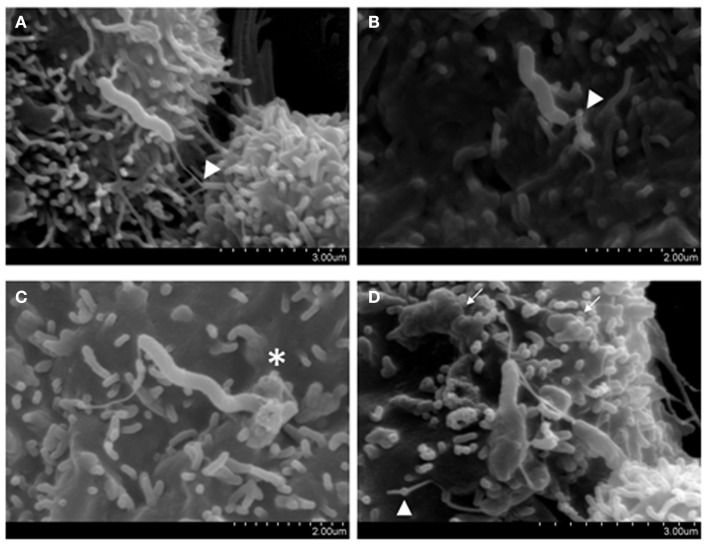 Campylobacter concisus
