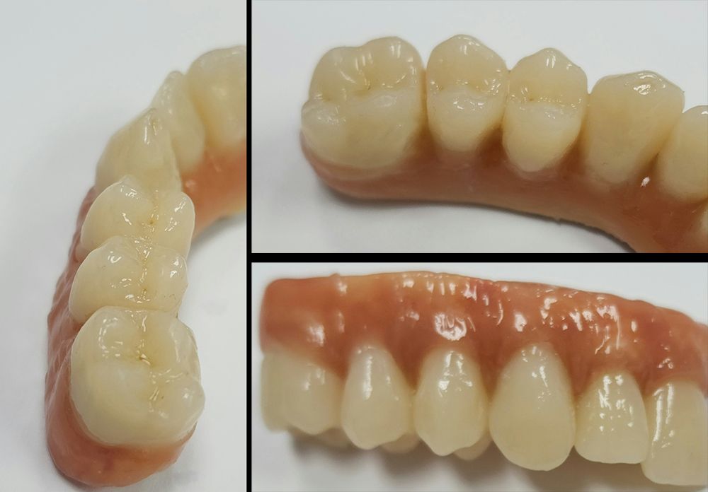 Polymer Tooth This Material Is Guiding the Way Toward “Polymer Dentistry”