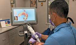Key upgrades make for easier intraoral scanning