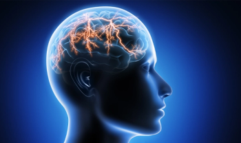 Seizure Brain