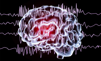 epilepsy 