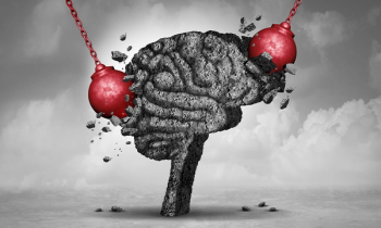 migraine hammers hitting brain