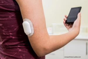 Continuous Glucose Monitoring and Its Part in Diabetes Management