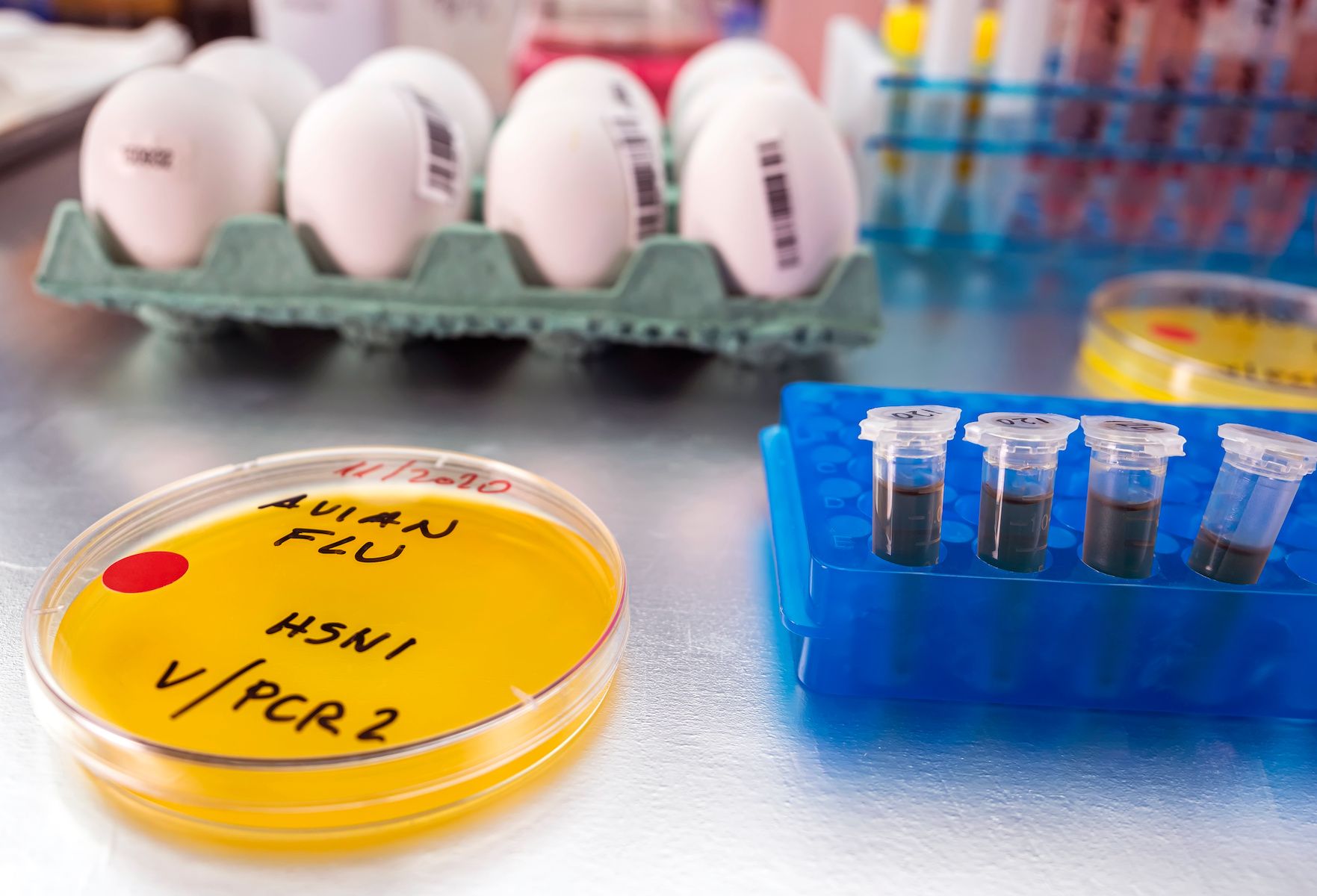 Slideshow Everything You Need To Know About The Us Bird Flu Outbreak Slideshow Everything You Need To Know About The Us Bird Flu Outbreak