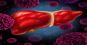 Liver Cancer