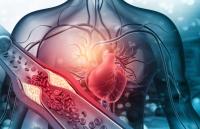 Cardiovascular Disease Now Leads as Cause of Death of Hispanic Adults