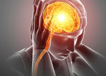 migraine diagram