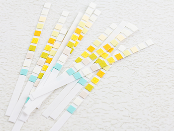 Test Strips