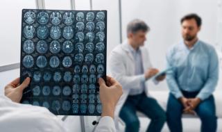 Workforce, Access Challenges Impede Patients’ Ability to Manage Migraines | NCPA 2025