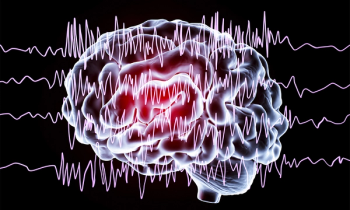 Epilepsy