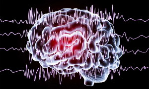 Seizures