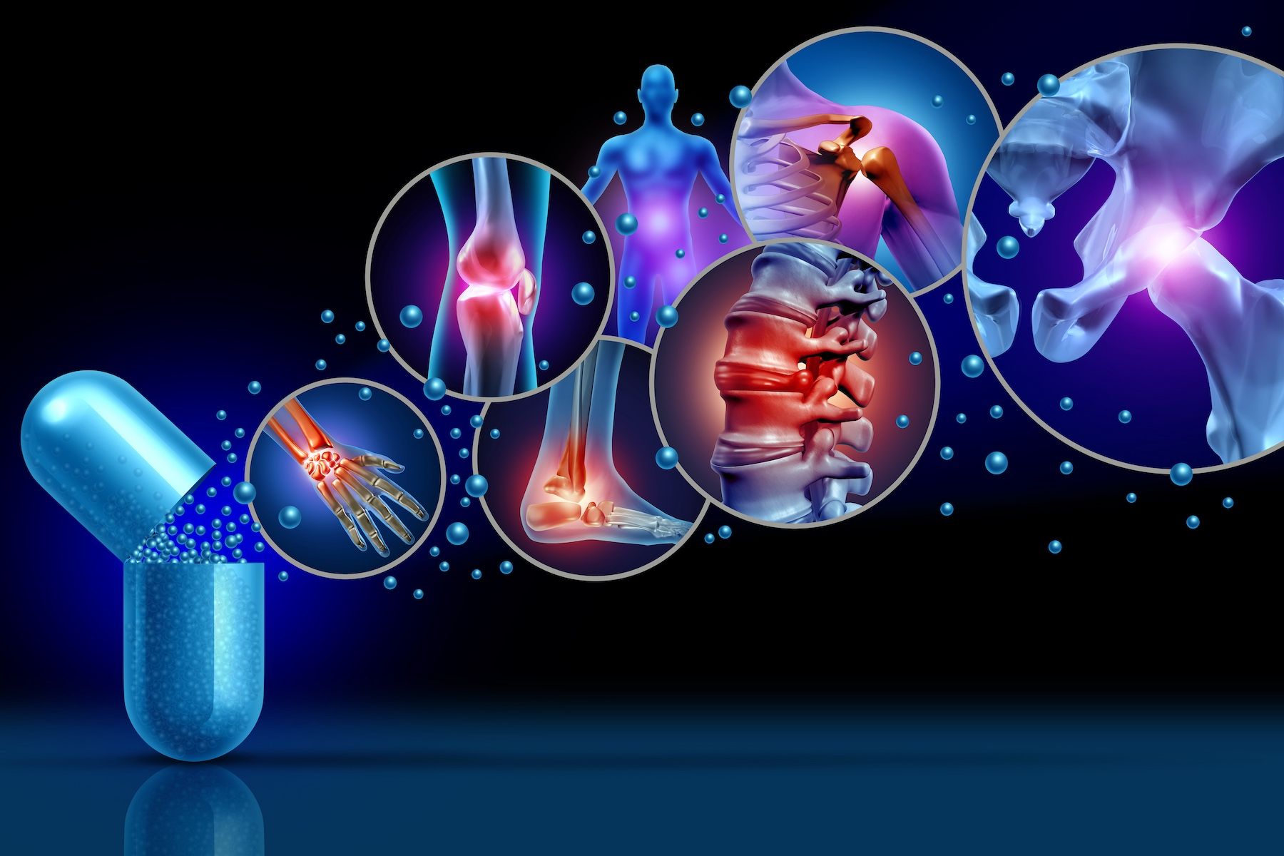 Nonopioid Treatment Offers Safer, Effective Alternatives for Pain Management