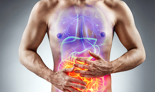 Irritable Bowel Syndrome