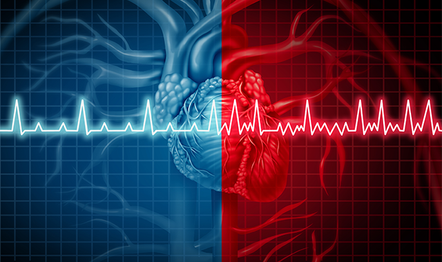 Atrial Fibrillation Illustration_199955974