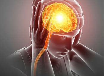 migraine