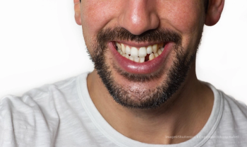 Missing tooth