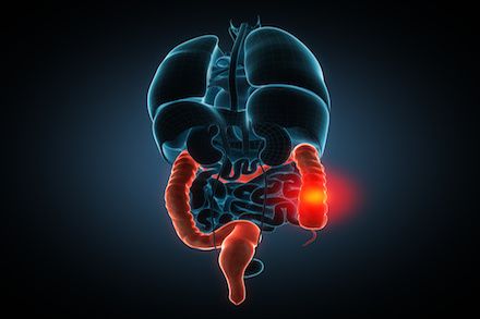 Gastrointestinal