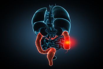 Gastrointestinal