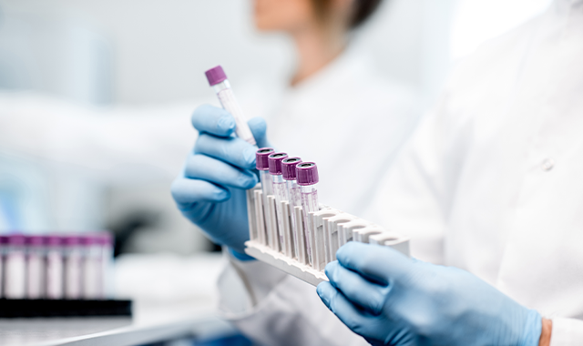 scientist holding lab test tubes