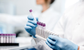 scientist holding lab test tubes