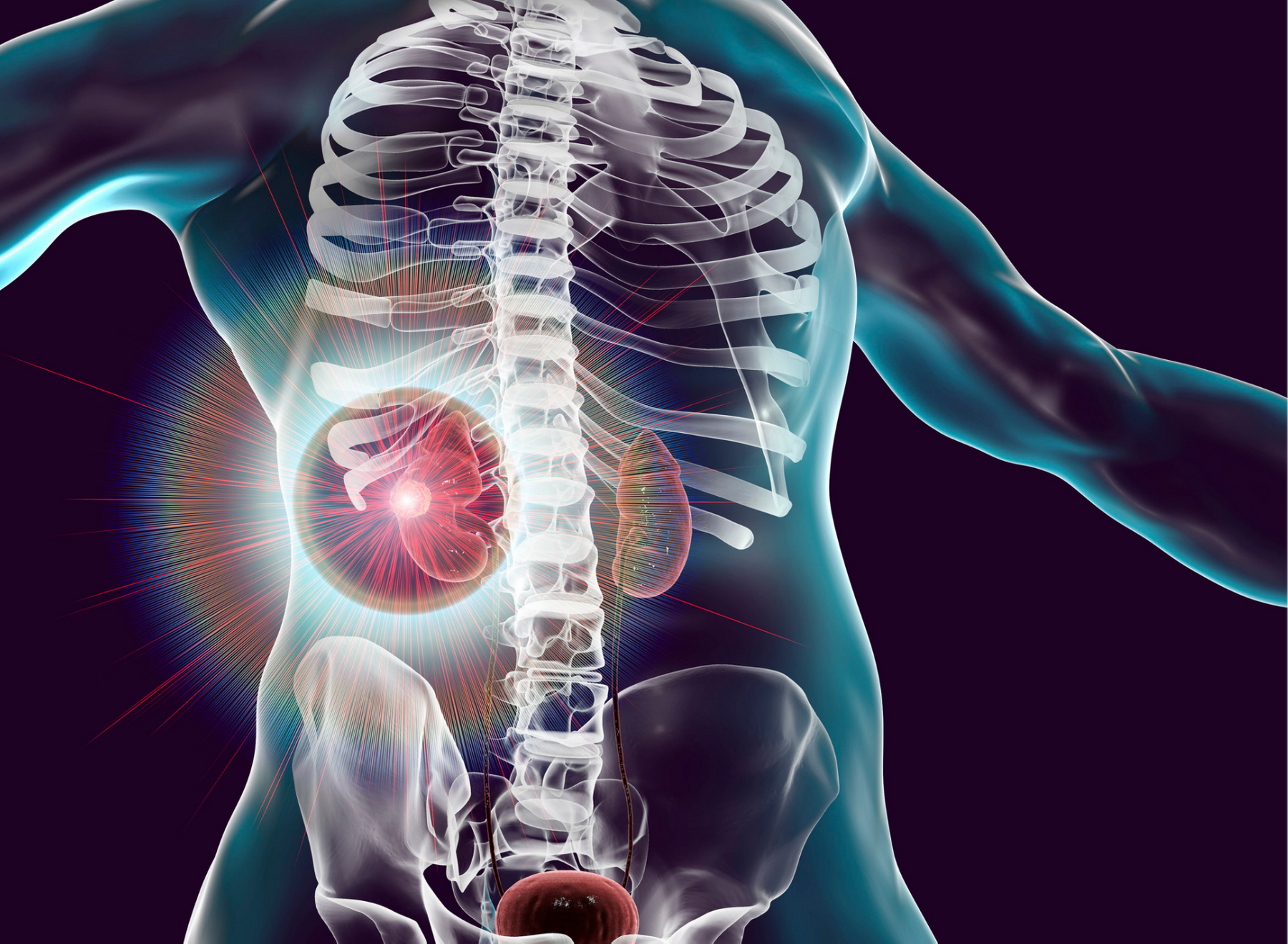 Chronic kidney disease