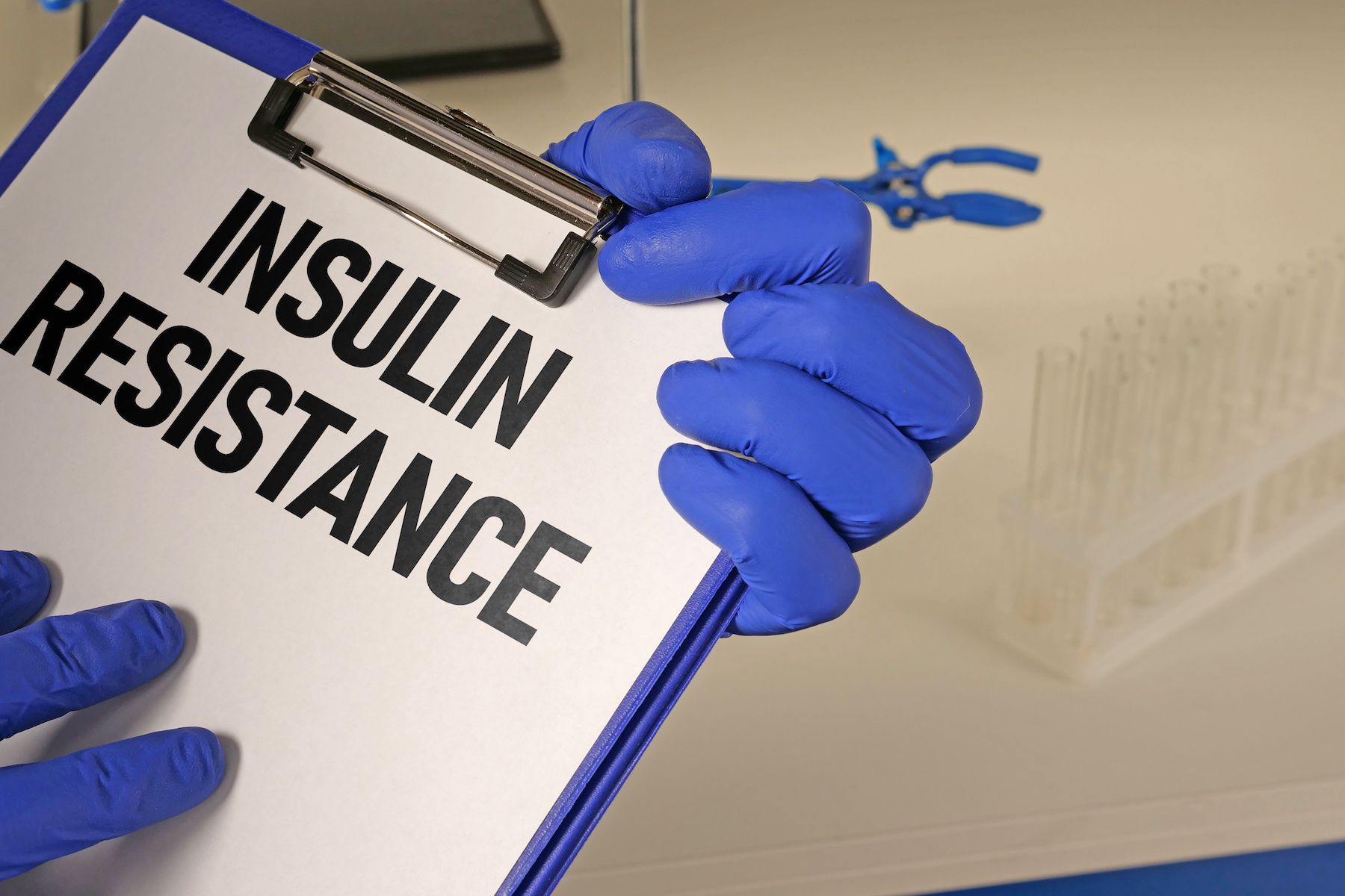 Insulin Resistance, Insulin Resistance Symptoms, What is Insulin Resistance​