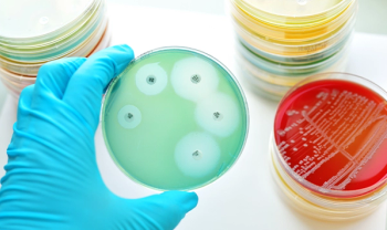 antibiotic resistance testing on Petri dish
