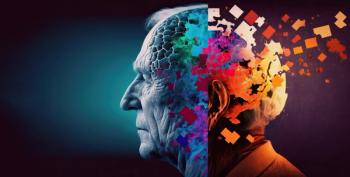 Alzheimer disease | Image Credit: Zerbor - stock.adobe.com