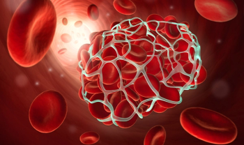 Blood Clot