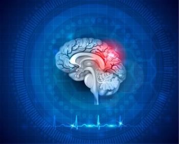concussion brain damage | Image Credit: reineg - stock.adobe.com.jpeg