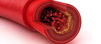 Cholesterol