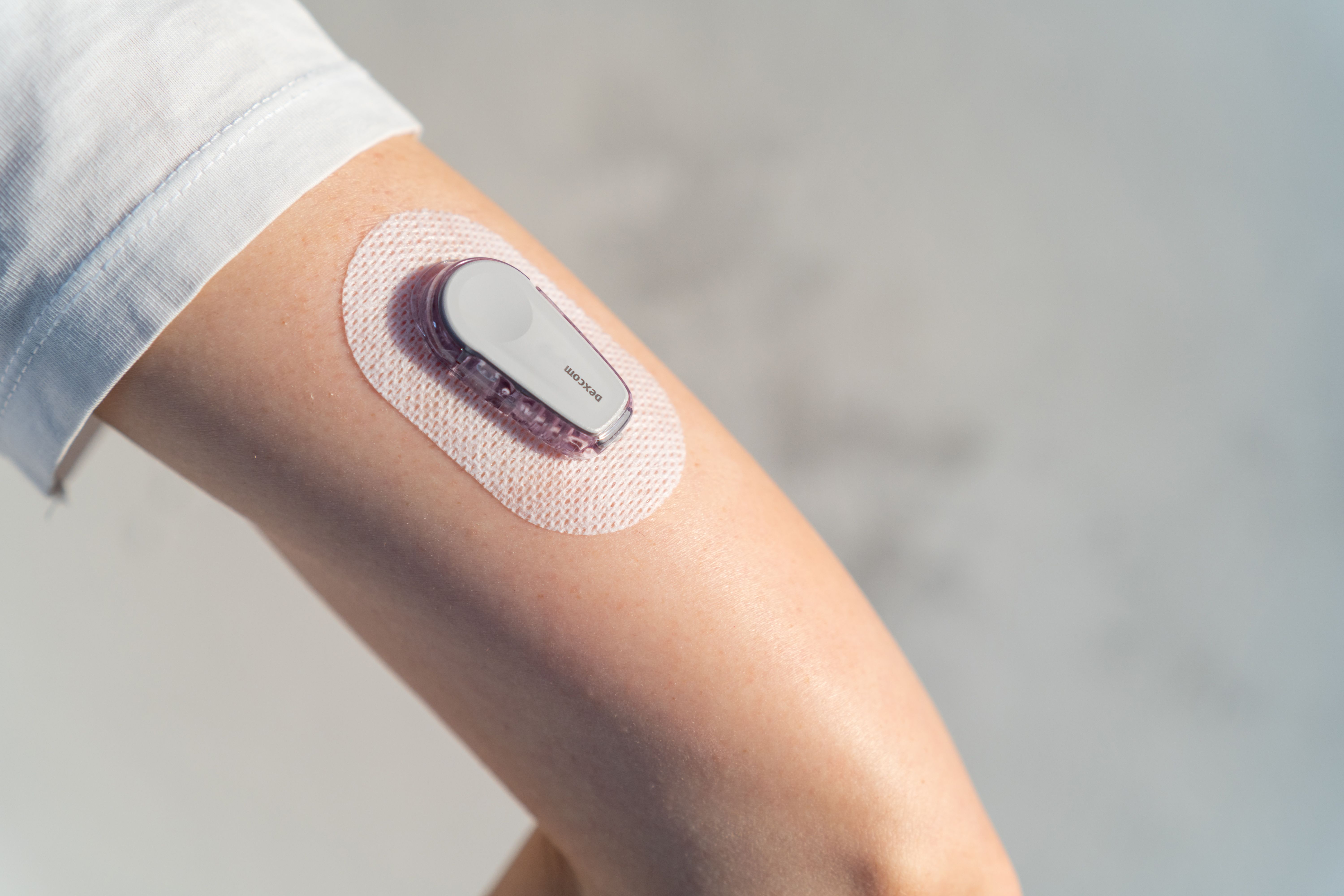 Pharmacists Applaud New Bionic Pancreas for Type 1 Diabetes