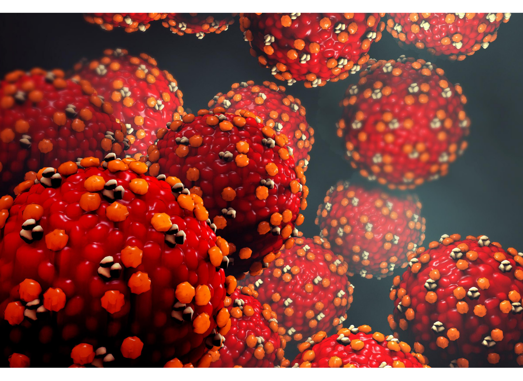 Shingles