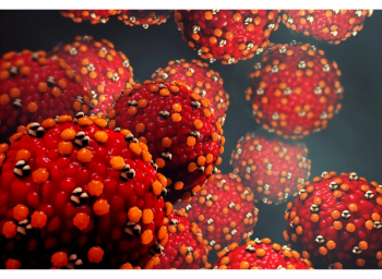 Shingles