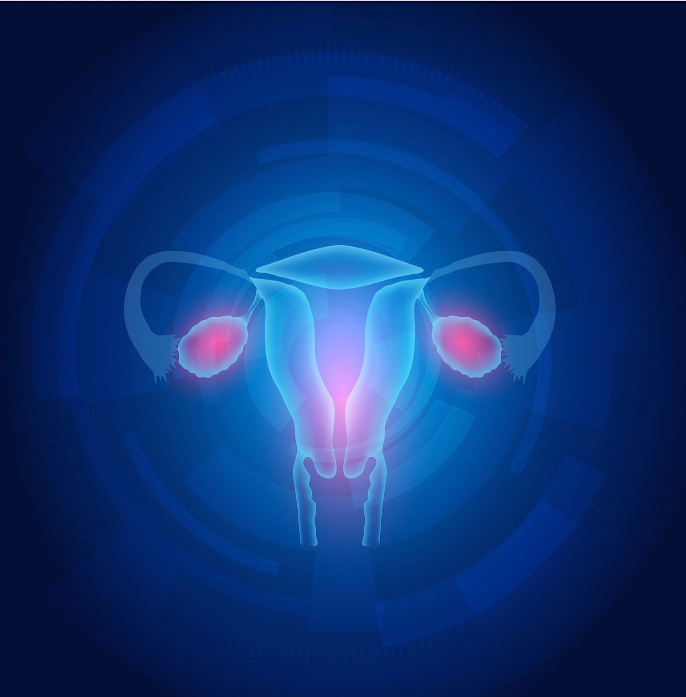 Ovarian Cancer Treatment Update and Pharmacists' Role