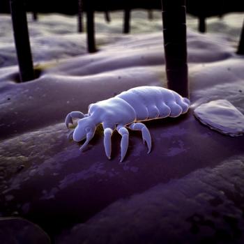 Head lice