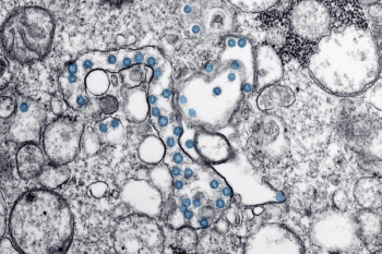 Coronavirus COVID-19
