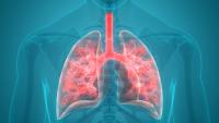 Vaccine Serotypes Reemerge in Community-Acquired Pneumonia