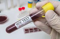 Once Weekly Oral HIV Regimen Maintains Suppression Through Week 48