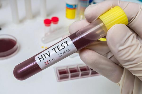 Once Weekly Oral HIV Regimen Maintains Suppression Through Week 48