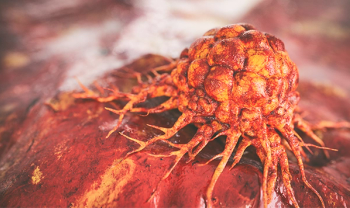 Cancer cell