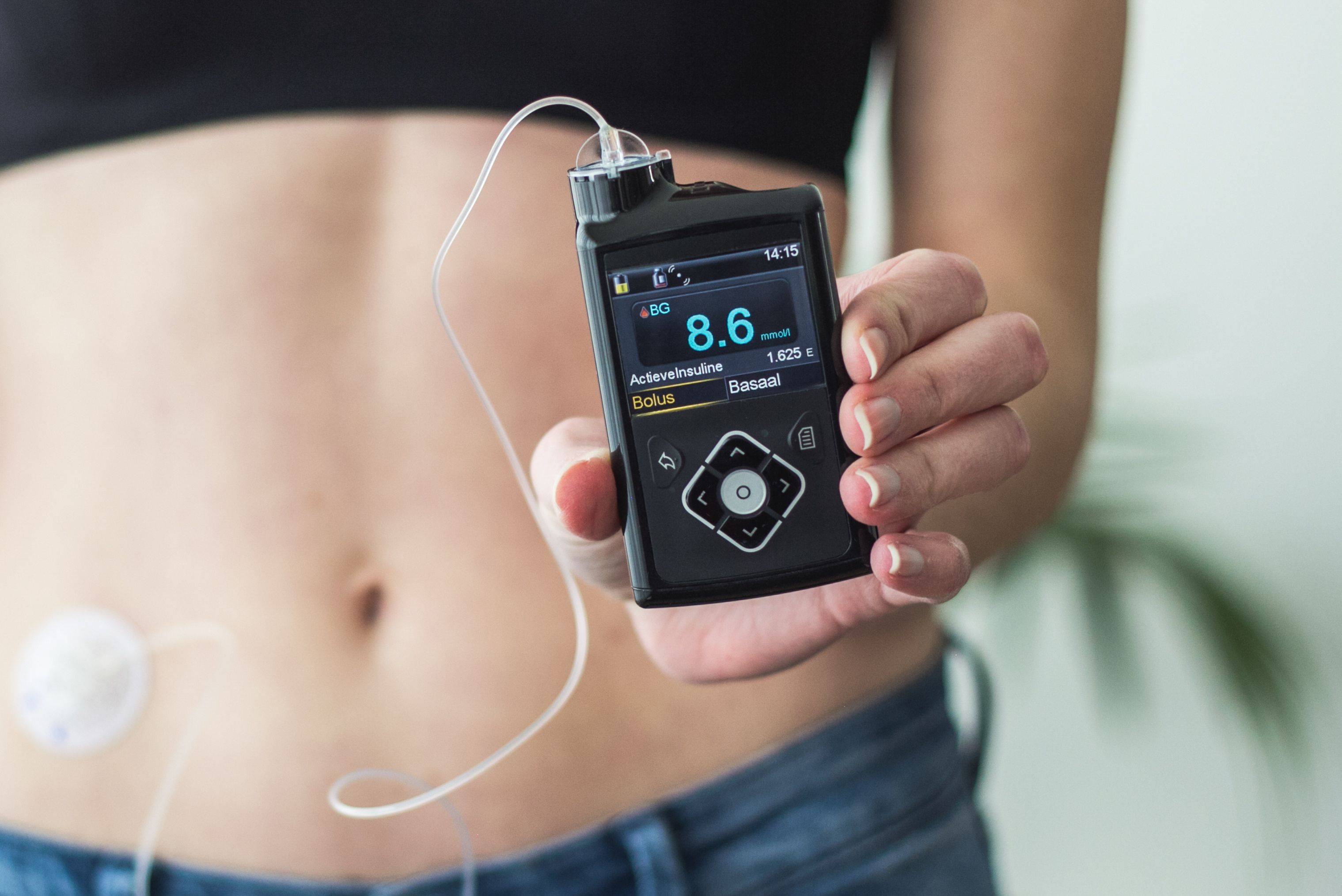 <![CDATA[Pharmacists Help Patients Manage Insulin Pumps for Type 2 Diabetes | ASHP Midyear 2025]]>