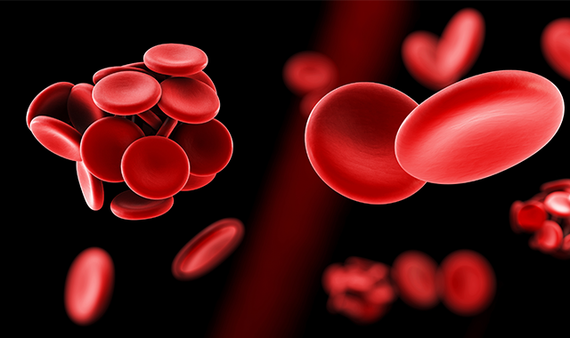 RBC blood clot