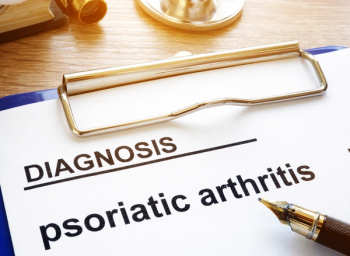 psoriatic arthritis