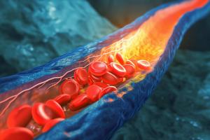 How Nonstatin Therapies Can Optimize Patients’ Cardiovascular Health | ASHP Midyear