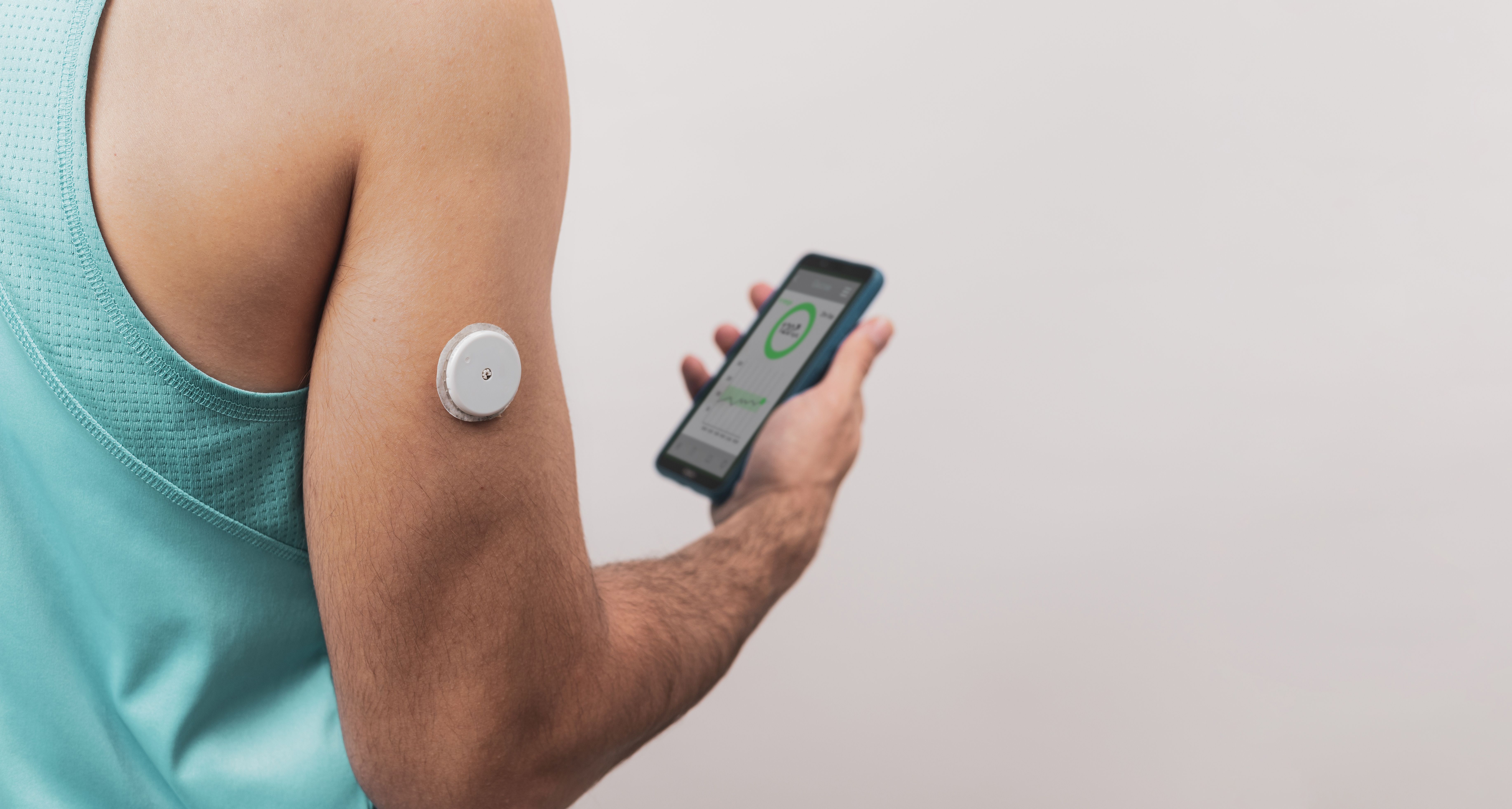 Pharmacist Involvement Improves Glycemic Outcomes With CGMs