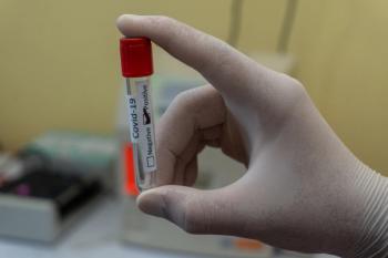 Positive COVID-19 test