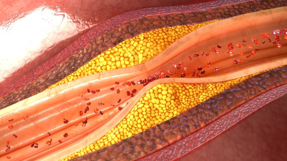 Cholesterol