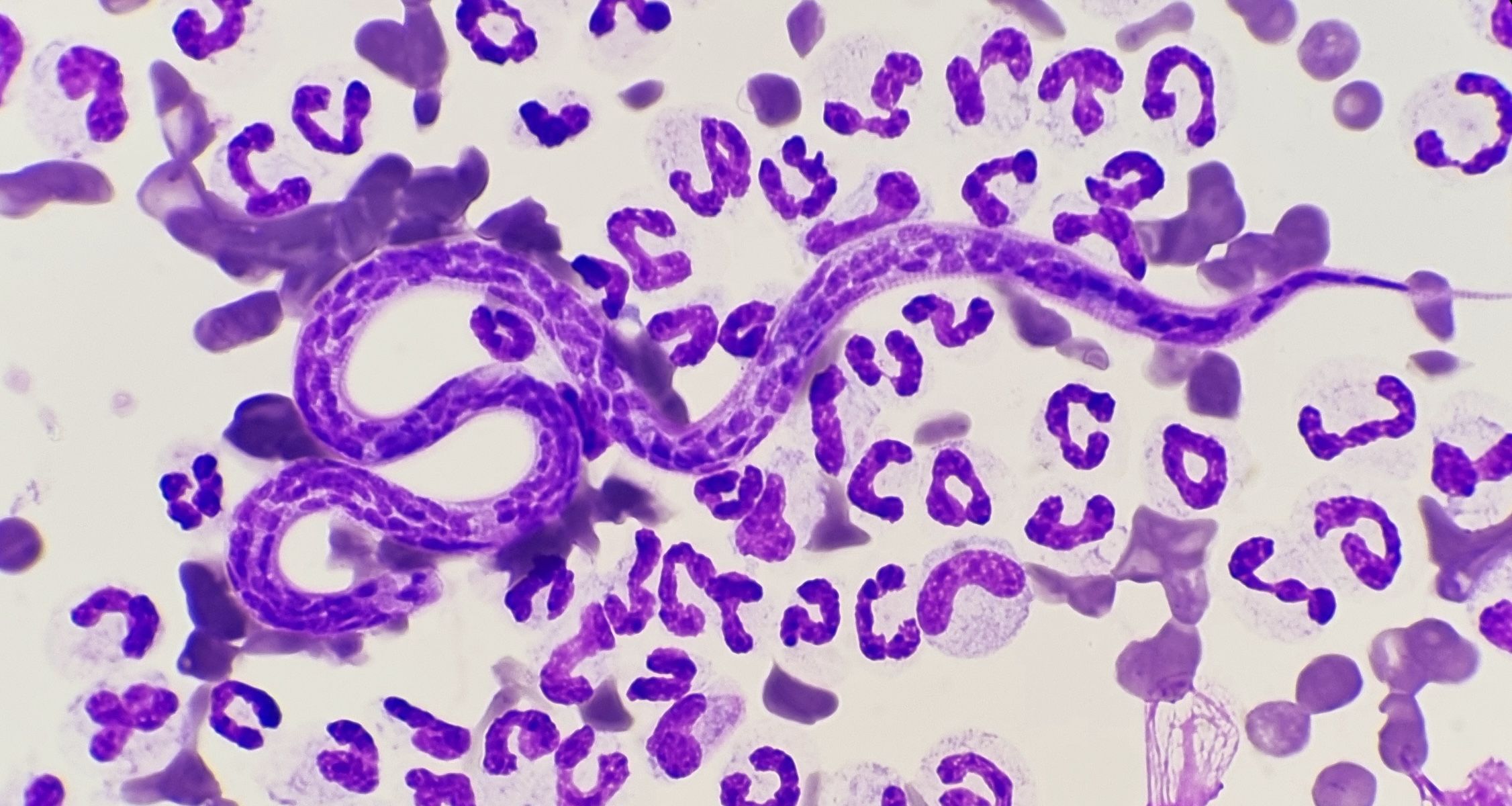 Heartworm