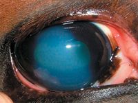 Verticalcornealedema-846171-1404209271706.jpg